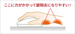 手に合ってないマウスを使い続けると腱鞘炎になりやすい！
